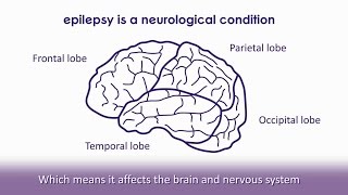 Surprising Signs of Epileptic Seizures [upl. by Mail]