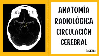 Anatomía Radiológica  Tomografía Computarizada Circulación cerebral [upl. by Thgiwed861]