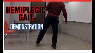 HEMIPLEGIC GAITGAIT DEMONSTRATION [upl. by Anilasor355]