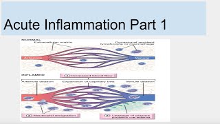 Acute Inflammation Part 1 [upl. by Anilrats]