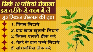 पिम्पल्स दाद खाज खुजली स्किन की एलर्जी इन्फेक्शन ब्लैकहेड्सचेहरे के दागधब्बे सोराइसिस का इलाज [upl. by Ahcurb323]