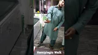 Hemiplegic Cerebral palsy  Hemiplegic gait [upl. by Cadal929]