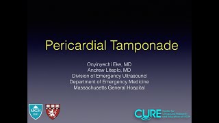 Pericardial Tamponade [upl. by Dlarrej]