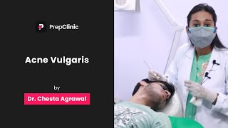 Acne Vulgaris  Dr Chesta Agrawal  Dermatology PrepClinic [upl. by Aitenev749]