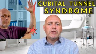 Cubital Tunnel Syndrome Top5 Preventative Measures [upl. by Ecnerolf]