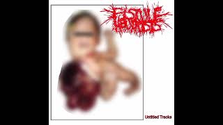 Fistule Neurosis  Untitled Tracks [upl. by Ahtanoj992]