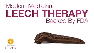 Modern Medicinal Leech Therapy Backed by FDA  John Douillards LifeSpa [upl. by Yenalem872]