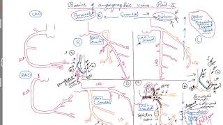 how steam injectors work [upl. by Stormi]