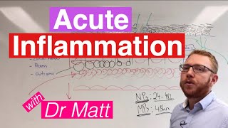 Acute Inflammation  Immunology [upl. by Dayir517]