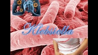 Klebsiella [upl. by Artemus]