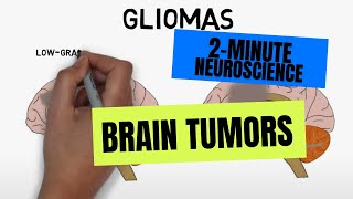 2Minute Neuroscience Brain tumors [upl. by Calendre728]