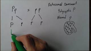 Introducing Genetics 4 Autosomal dominant inheritance [upl. by Dewhurst]