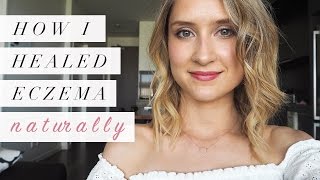 How I Healed Eczema Naturally  My Story [upl. by Sirenay]