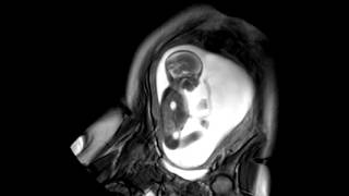 Foetal Development Unborn Baby Movement at 24 Weeks  WIRED [upl. by Tnarg]