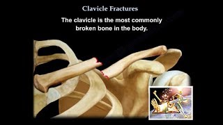 How to describe a fracture [upl. by Gussi]