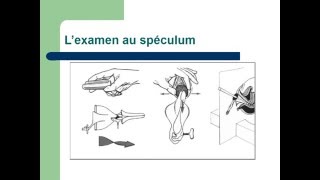 GYNECOLOGIE L’examen en gynécologie [upl. by Portland]