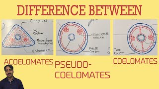 Acoelomates Pseudocoelomates and coelomates  Triploblastic organisation [upl. by Ruhtua]