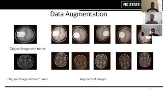 Brain Tumor Detection using Convolutional Neural Network [upl. by Dranrev]