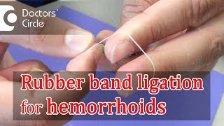 What is Rubber Band Ligation  Dr Rajasekhar M R [upl. by Araht369]