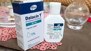 Dalacin T Lotion for acne Review usage Benefit Price Remove Pimples acne best solution for acne [upl. by Nemrak]