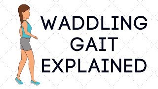 Waddling Gait Explained [upl. by Ataeb]