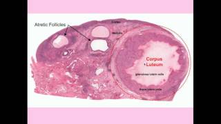 Ovarian Cysts  CRASH Medical Review Series [upl. by Urquhart559]