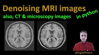 94  Denoising MRI images also CT amp microscopy images [upl. by Skipper]