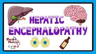 Hepatic Encephalopathy  Pathophysiology Stages and West Haven Criteria [upl. by Dihahs]