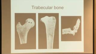 11 Trabecular Bone and Osteoporosis [upl. by Nnairrek797]