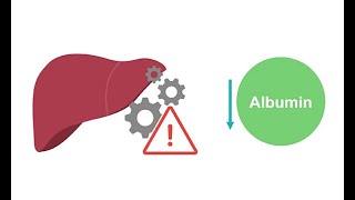 Getting to know albumin physiology [upl. by Weibel]