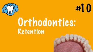 Orthodontics  Retention  INBDE ADAT [upl. by Bruell]