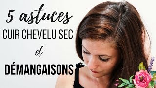 ⚠CUIR CHEVELU SEC démangeaisons et pellicules  5 conseils soins [upl. by Sherrod678]