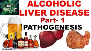 ALCOHOLIC LIVER DISEASE Part 1 Pathogenesis [upl. by Denyse237]