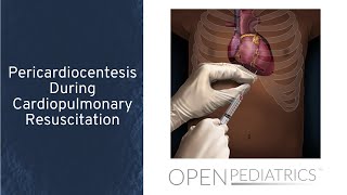 Pericardiocentesis During Cardiopulmonary Resuscitation by T Wolbrink  OPENPediatrics [upl. by Gnouhk]