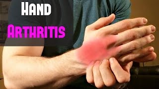 Fast Treatment for Hand Arthritis  Self Massage [upl. by Koblick]