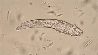 Demodex canis mites [upl. by Li]