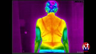 Full body Thermography [upl. by Allicerp76]