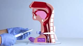 Tracheostomy TOM Cuff Deflation [upl. by Sanfred]