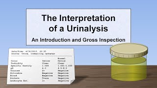 Interpretation of the Urinalysis Part 1  Introduction and Inspection [upl. by Shuler]