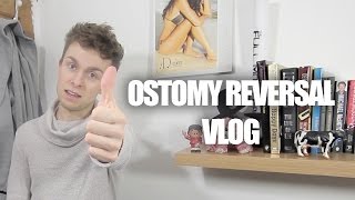 My Stoma Reversal Surgery  Ostomy Vlog [upl. by Shih]